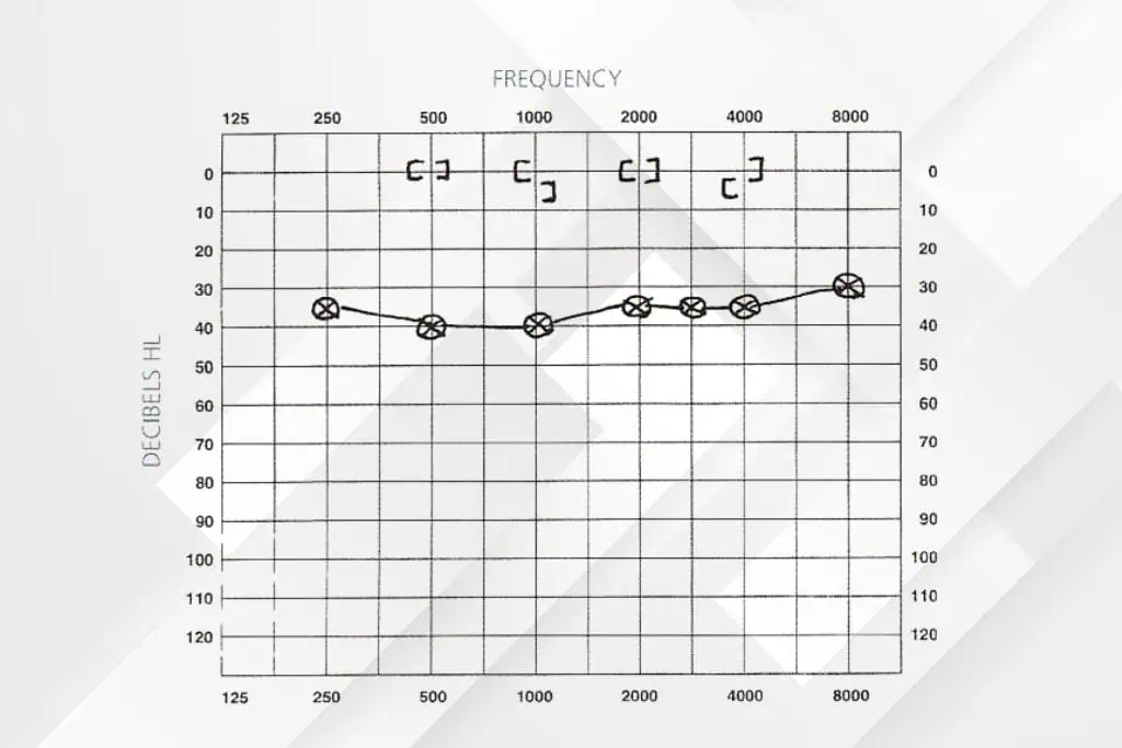 Audiogram